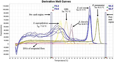 Multiplex high-resolution melting assay for simultaneous detection of five key bacterial pathogens in urinary tract infections: A pilot study